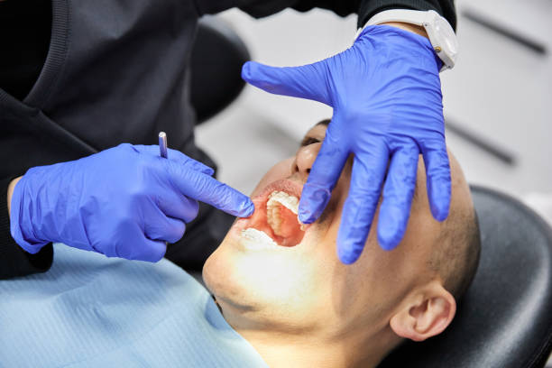Best Emergency Dentist for Knocked-Out Tooth in Billington Heights, NY